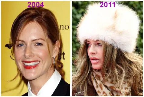 trinny woodall plastic surgery Image 6